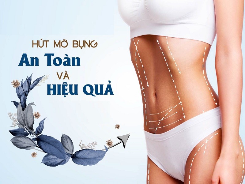 Hút mỡ bụng an toàn, hiệu quả