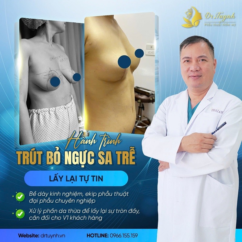 Địa chỉ phẫu thuật sửa ngực sa trễ