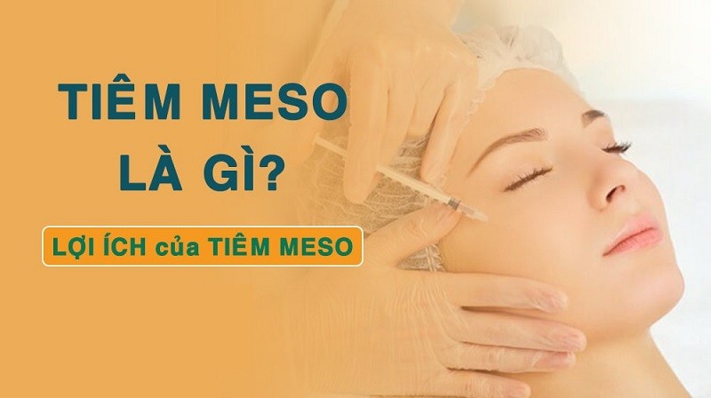 Tiêm meso là gì?