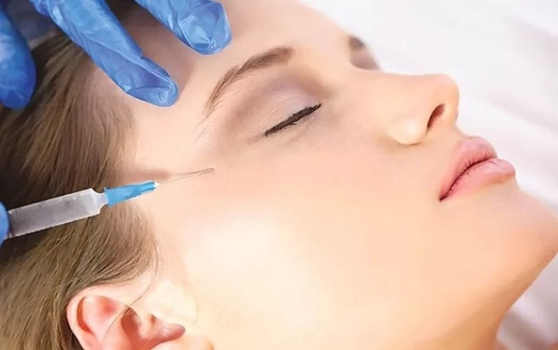 Tiêm botox để xoá nếp nhăn đuôi mắt