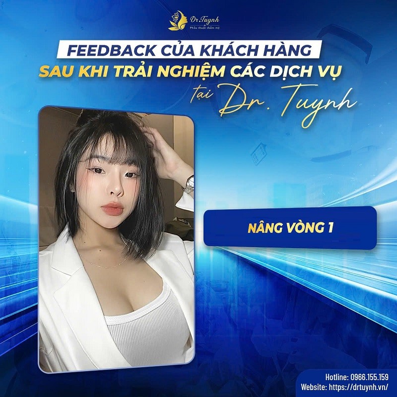 Cải thiện vóc dáng sau khi nâng vòng 1