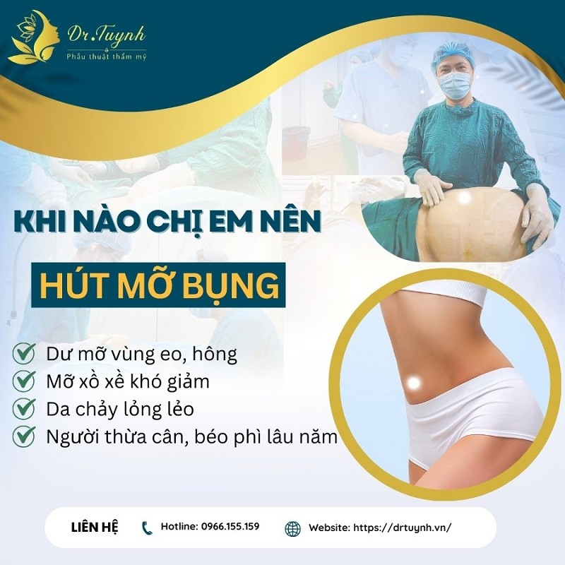 Khi nào chị em nên hút mỡ bụng